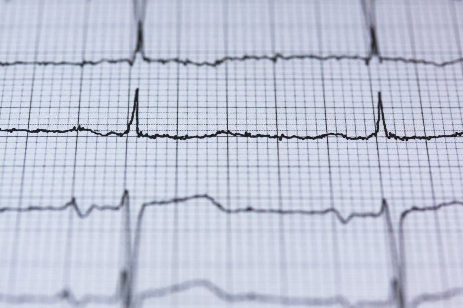 Best Heart Rate Monitors